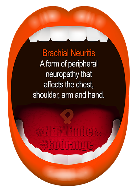 Brachial Neuritis nervember go orange ipain Brachial Neuritis nervember go orange ipain