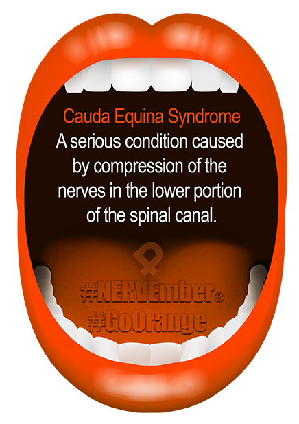 Cauda Equina Syndrome NERVEmber GoOrange iPain Cauda Equina Syndrome NERVEmber GoOrange iPain