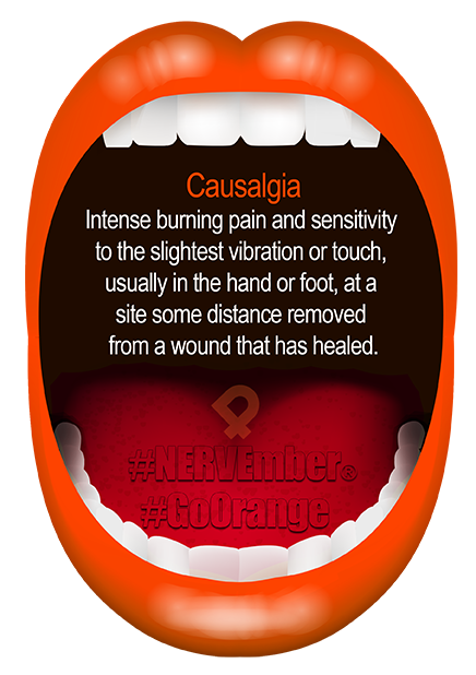 Causalgia nervember go orange ipain