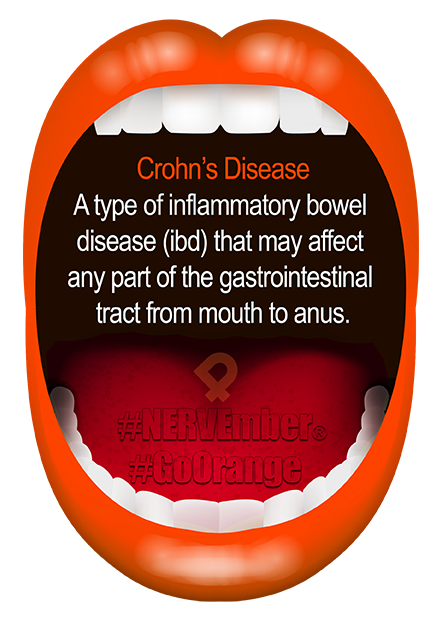 Crohn’s disease nervember go orange ipain