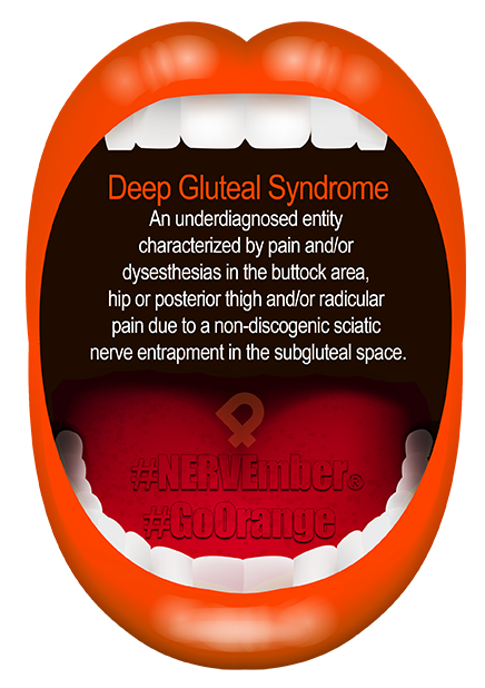 Deep gluteal syndrome nervember go orange ipain