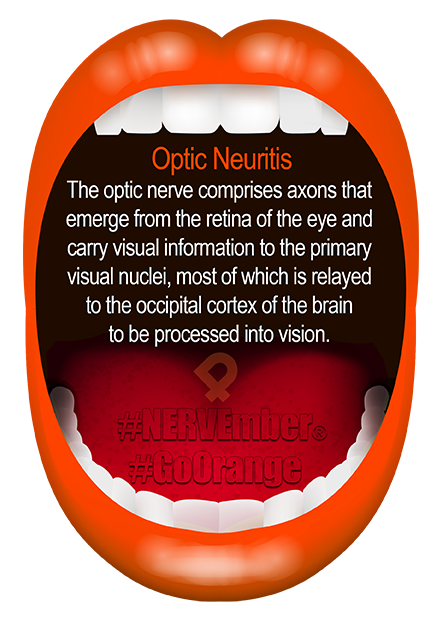 Optic Neuritis nervember go orange ipain