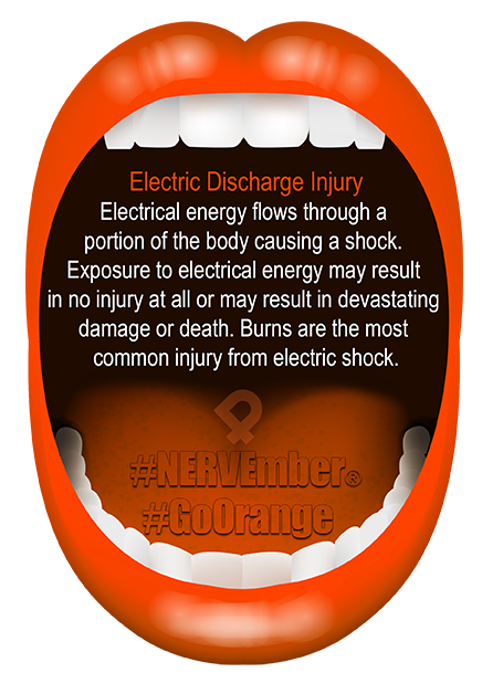 Electric Discharge Injury NERVEmber GoOrange iPain