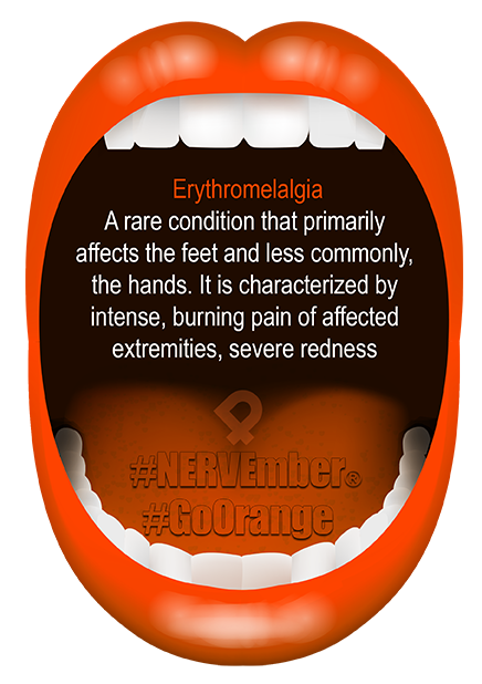 Erythromelalgia NERVEmber GoOrange iPain
