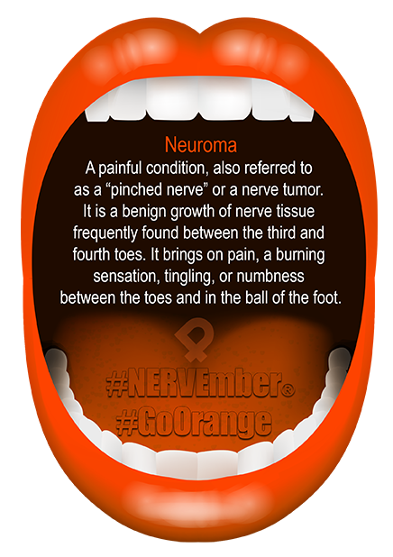 Neuroma NERVEmber GoOrange iPain