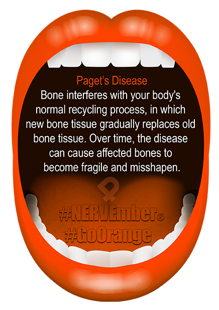 Pagets Disease NERVEmber GoOrange iPain