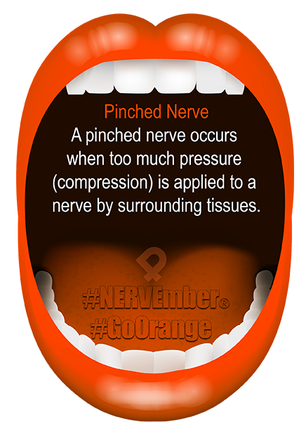 Pinched Nerve NERVEmber GoOrange iPain