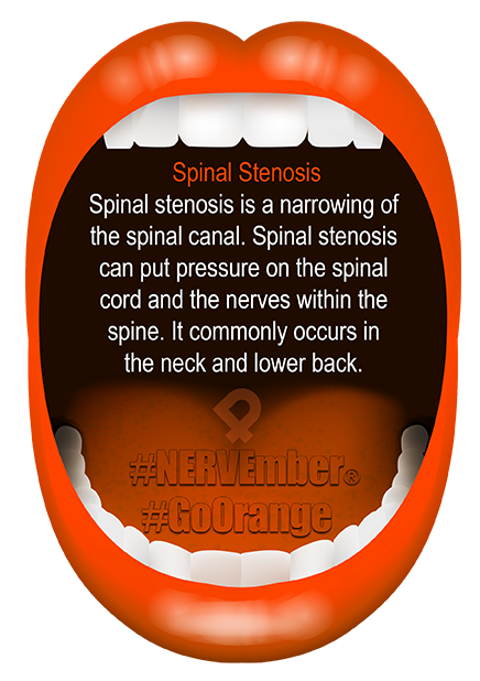 Spinal Stenosis NERVEmber GoOrange iPain