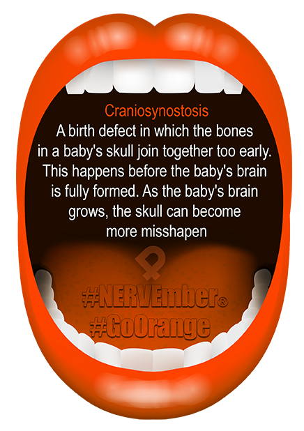 Craniosynostosis NERVEmber GoOrange iPain