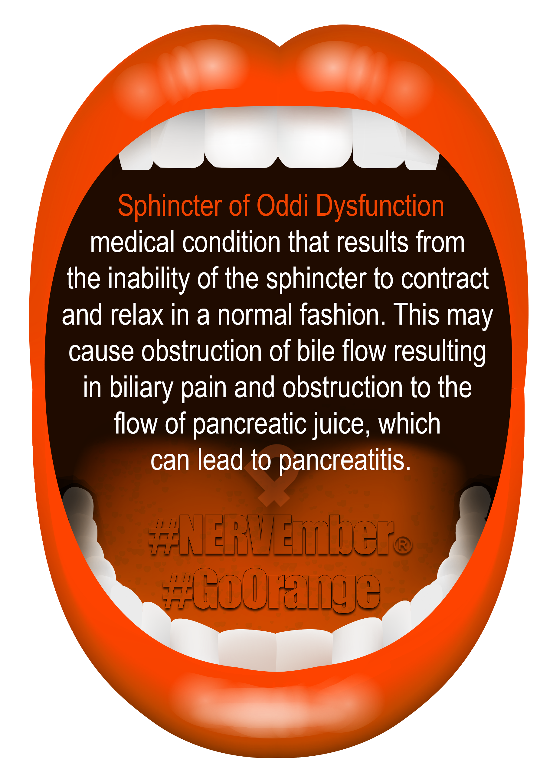 Sphincter Of Oddi NERVEmber GoOrange iPain